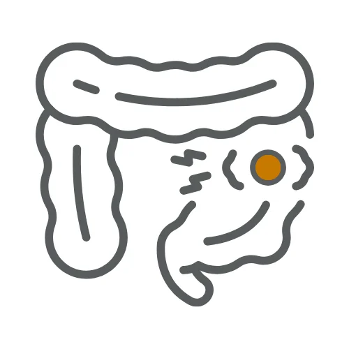 Ulcerative colitis